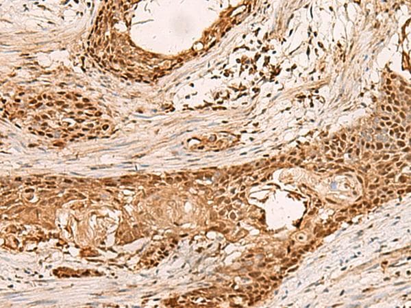 Polyclonal Rabbit anti-Human PAFAH1B2 Antibody (IHC)