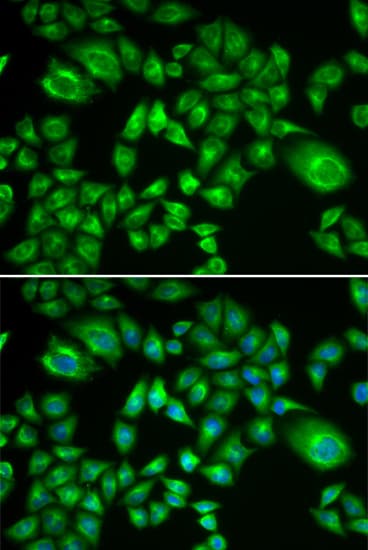 H6PD / G6PDH Antibody