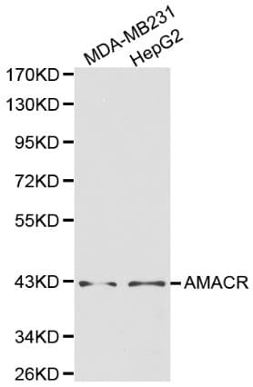 AMACR / P504S Antibody