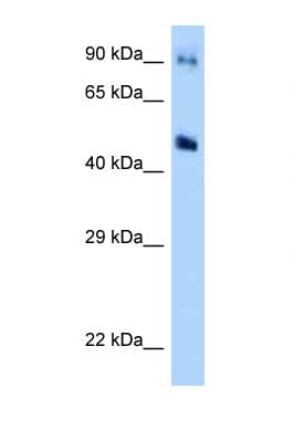 GDA / Nedasin Antibody (aa171-220)