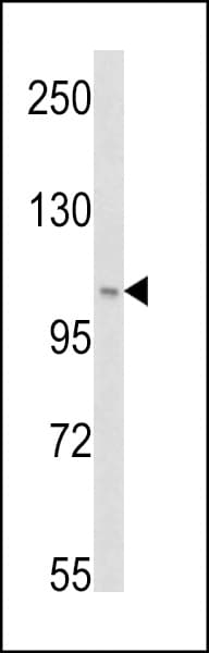 IHC-plus™ PIK3C3 / VPS34 Antibody (Ser34)