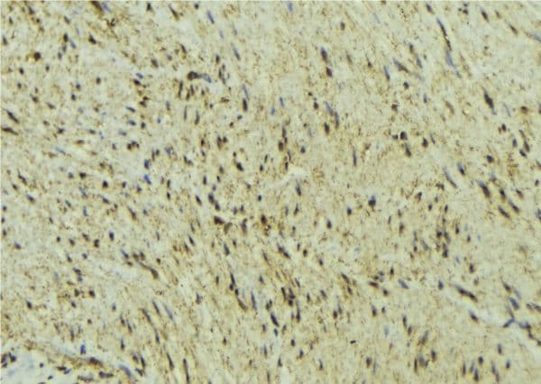Polyclonal Rabbit anti-Human DNMT3A Antibody (IHC, WB)