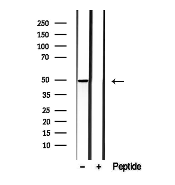 Polyclonal Rabbit anti-Human MMP28 Antibody (IHC, IF, WB)