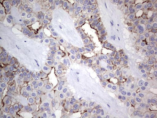 Monoclonal Mouse anti-Human CAPN5 / Calpain 5 Antibody (clone OTI7F2, aa274-578, IHC)