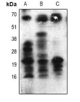 Polyclonal Rabbit Acetyl-Lysine Antibody (IHC, WB)