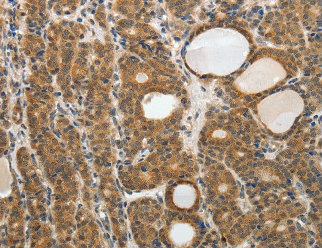 Polyclonal Rabbit anti-Human RARA / RAR Alpha Antibody (IHC)
