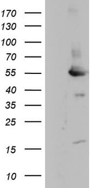 MAPKAPK5 / PRAK Antibody (aa197-471, clone OTI1A7)
