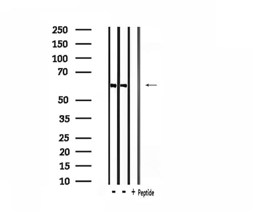Polyclonal Rabbit anti-Human CLCC1 Antibody (IF, WB)
