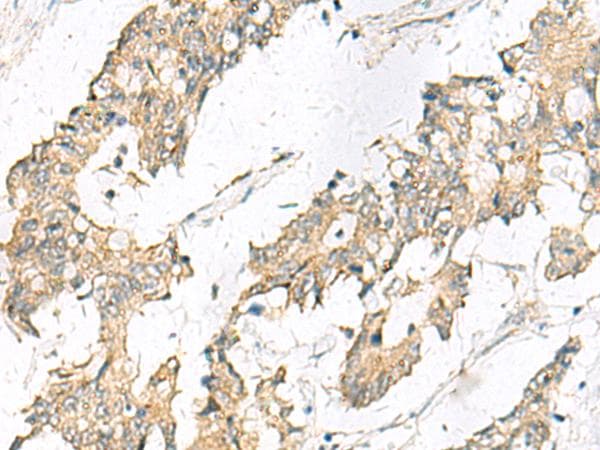 Polyclonal Rabbit anti-Human MGAT4B Antibody (IHC)