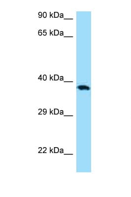 Polyclonal Rabbit anti-Human CD276 / B7-H3 Antibody (C-Terminus, WB)