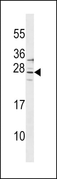 Polyclonal Rabbit anti-Human SIRPD Antibody (aa107-133, WB)