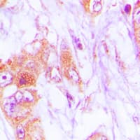 Polyclonal Rabbit anti-Human CDKL4 Antibody (C-Terminus, IHC, IF, WB)