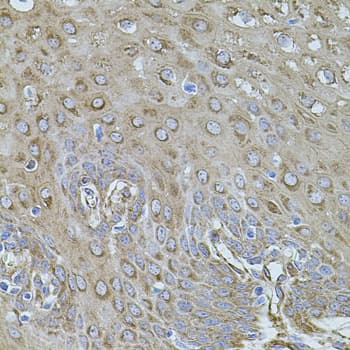 FLNB / TAP Antibody