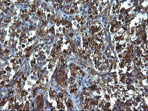 FNDC8 Antibody (clone OTI1C10)