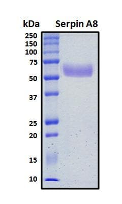Human AGT / Angiotensinogen Protein (Recombinant His, N-Terminal)