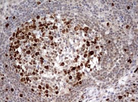 TOP2A / Topoisomerase II Alpha Antibody (aa1100-1531, clone OTI2A9)