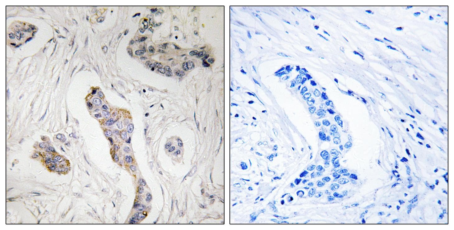 Polyclonal Rabbit anti-Human PBOV1 Antibody (IHC, IF, WB)