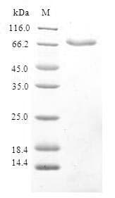 Human RRM2B / P53R2 Protein (Recombinant GST, N-terminus)
