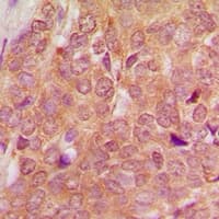 TSEN54 Antibody (Internal)