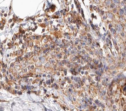 Polyclonal Rabbit anti-Human BCAR3 Antibody (IHC, IF, WB)