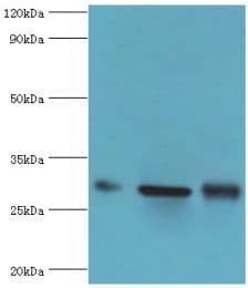 PRKAB2 / AMPK Beta 2 Antibody (aa1-272)