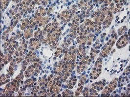 DSTN / Destrin Antibody (clone OTI1D8)