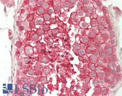 IHC-plus™ Polyclonal Rabbit anti-Human Basigin / Emmprin / CD147 Antibody (aa 138-321, IHC, WB)
