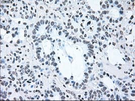 BRAF / B-Raf Antibody (clone OTI4C11)