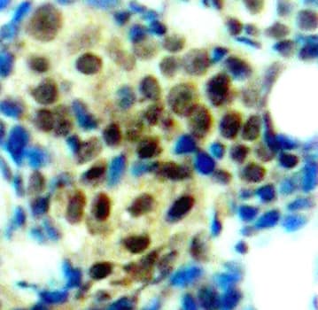 MAPK3 / ERK1 Antibody (phospho-Thr202)