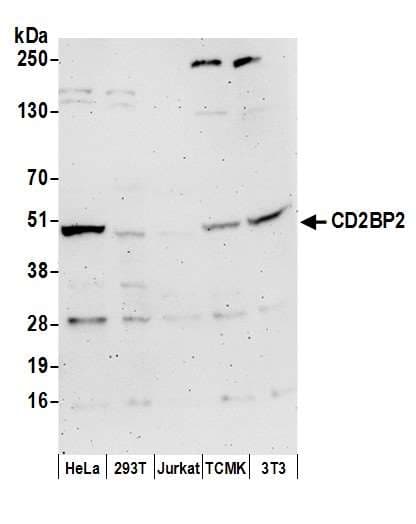 CD2BP2 Antibody (aa275-325)