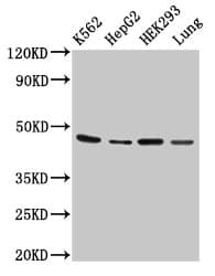 Polyclonal Rabbit anti-Human OXER1 Antibody (IHC, WB)