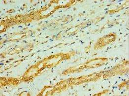 Polyclonal Rabbit anti-Human CPA1 / Carboxypeptidase A Antibody (aa111-419, IHC)