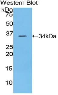 PTPRJ / CD148 Antibody (aa567-842)