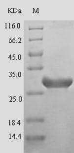 Atlantic cod EWSR1 / EWS Protein (Recombinant 6His-SUMO, N-terminus)