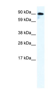 Polyclonal Rabbit anti-Human GRIK2 / GLUR6 Antibody (aa652-701, IHC, WB)
