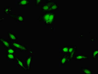 KDM5A / JARID1A Antibody