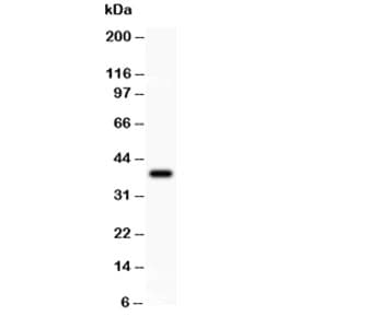 TP63 / p63 Antibody (aa311-680)