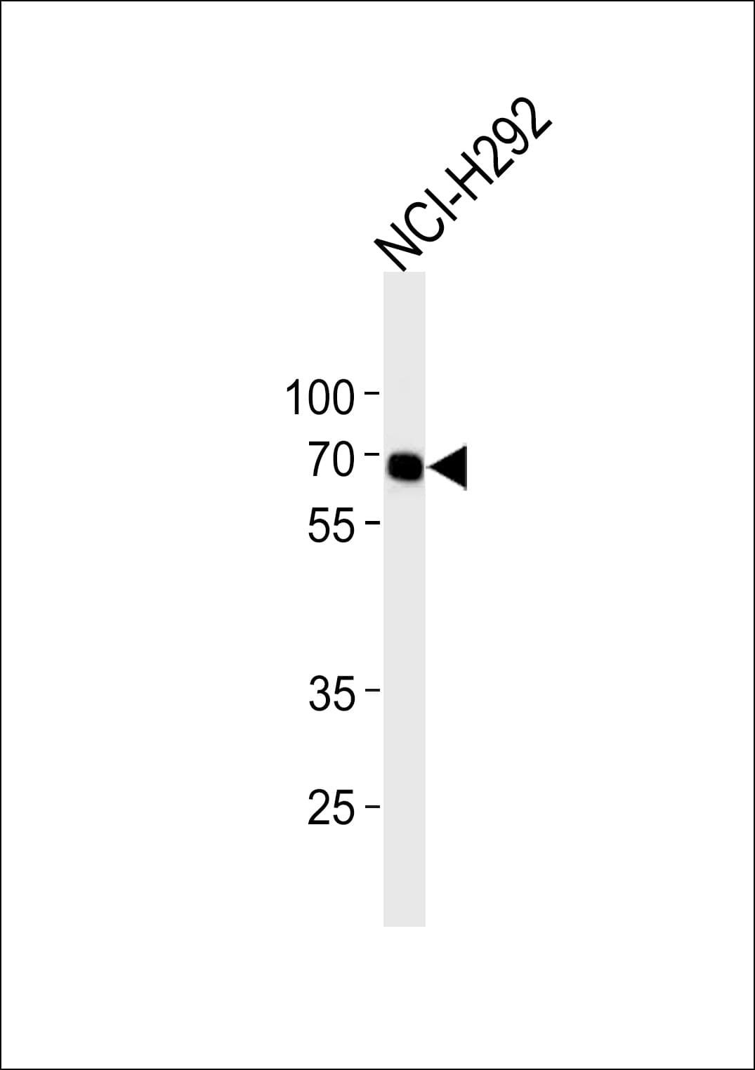 MMP14 Antibody (aa145-174)