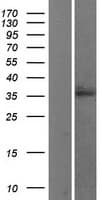 WNT2B Protein (Over-Expression Lysate Myc-DDK (Flag))