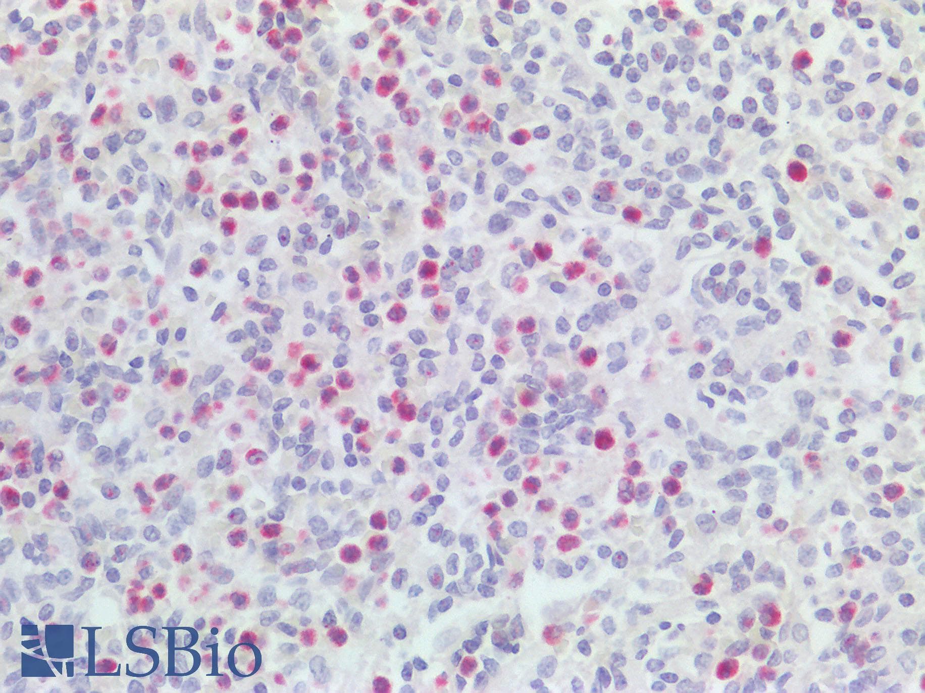 IHC-plus™ IL1F9 Antibody (clone 2F4)