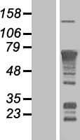 RELA / NFKB p65 Protein (Over-Expression Lysate Myc-DDK (Flag))