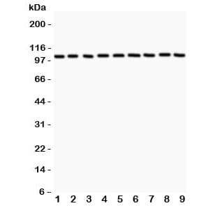 Alpha Catenin Antibody (aa143-292)