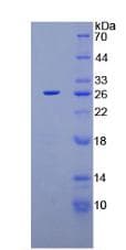 Rat XPC Protein (Recombinant His-T7)