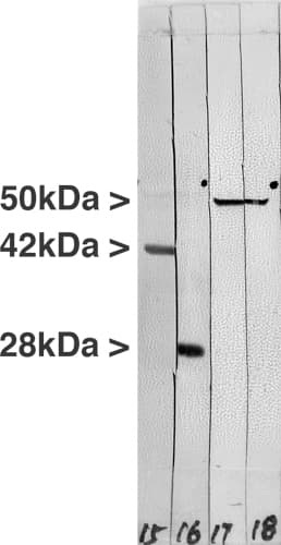 Vimentin Antibody (clone 2D1)