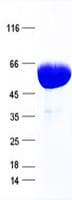Human COL1A1 / Collagen I Alpha 1 Protein (Recombinant His, N-Terminal)