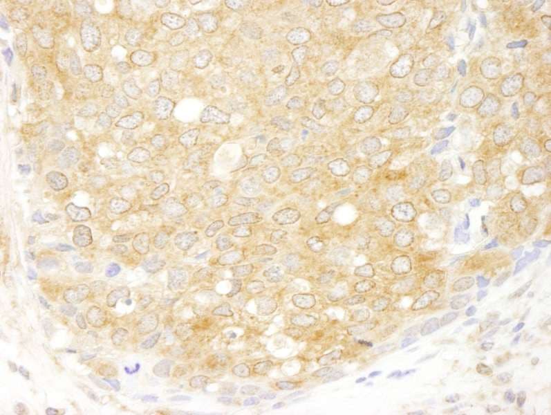 EIF2S2 Antibody (aa283-333)
