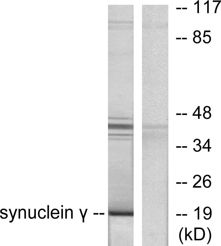 IHC-plus™ Polyclonal Rabbit anti-Human SNCG / Gamma-Synuclein Antibody (aa78-127, IHC, WB)