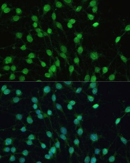 NR1I2 / PXR Antibody