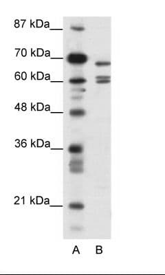 Polyclonal Rabbit anti-Human KCNK5 / TASK2 Antibody (aa421-470, IHC, IF, WB)