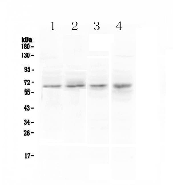 CCKBR / Cckb Antibody